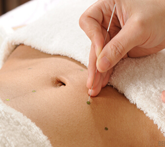 埋線減肥需辨體質(zhì) 什么人適合做埋線減肥