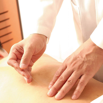 針灸如何減肥 針灸減肥的原理及功效