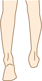 減肥跟體溫有關系 輕松減肥告別下半身肥胖