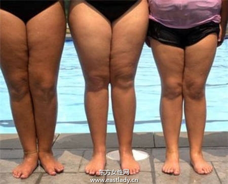 粗腿有三種 瘦腿方法大不同