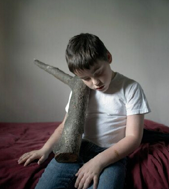 自閉癥的表現(xiàn) 患上自閉癥的原因有哪些