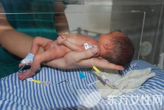 32周早產(chǎn)兒能存活嗎 導致早產(chǎn)的6大因素