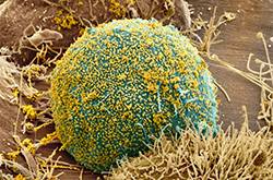 輪狀病毒疫苗什么時候接種 輪狀病毒疫苗的接種注意事項(xiàng)