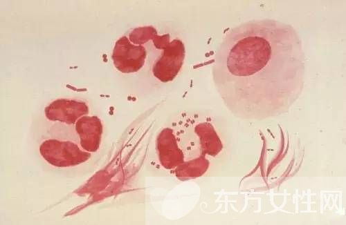 腦膜炎有什么癥狀 腦膜炎是什么原因引起的