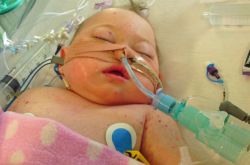 腦膜炎有什么癥狀 腦膜炎是什么原因引起的