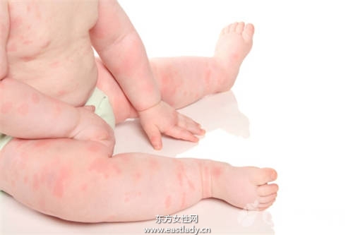 預(yù)防寶寶過敏 誤區(qū)大破解