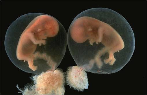 引發(fā)葡萄胎形成原因 4種高發(fā)人群需注意