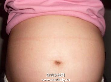 太陽對胎寶寶性別的干擾