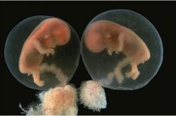 引發(fā)葡萄胎形成原因 4種高發(fā)人群需注意