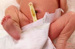 初生嬰兒臍帶護理方法 出現(xiàn)這些情況應及時就醫(yī)