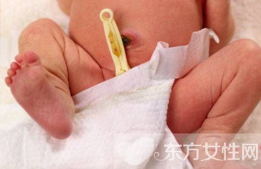 初生嬰兒臍帶護(hù)理方法 出現(xiàn)這些情況應(yīng)及時(shí)就醫(yī)