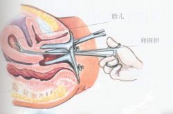 人工流產(chǎn)的最佳時間 人流后多久可以要小孩呢