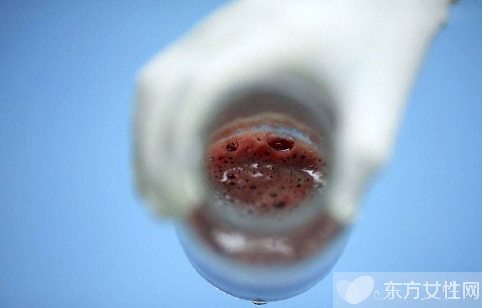 人流后多久來月經(jīng) 人流后多久可以要孩子