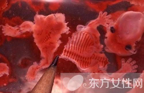 人工流產的最佳時間 人流后多久可以要小孩呢