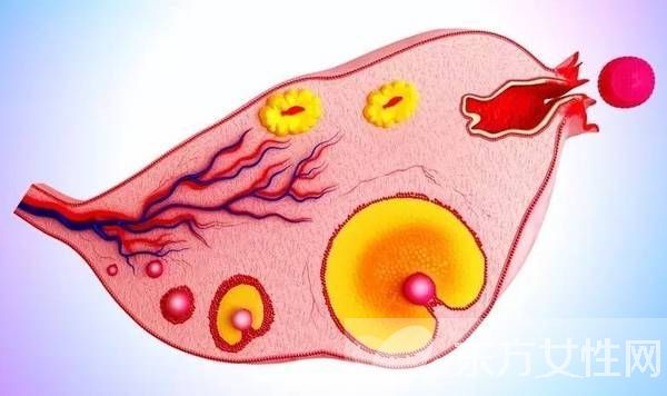多囊卵巢綜合癥是怎么引起的 這么做可以有效預(yù)防哦