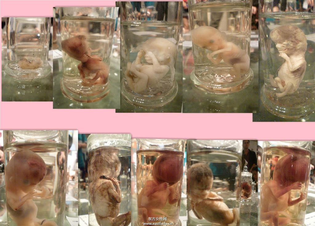 流產(chǎn)后吃什么好 這些流產(chǎn)后調(diào)養(yǎng)千萬(wàn)別忽略